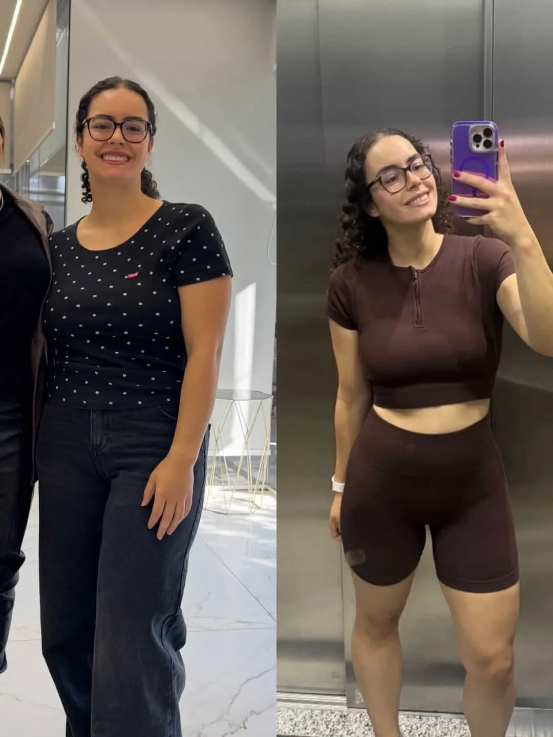 Antes e depois da Victória, paciente da Dra. Natália Daniela, após acompanhamento médico para emagrecimento com preservação de massa muscular.